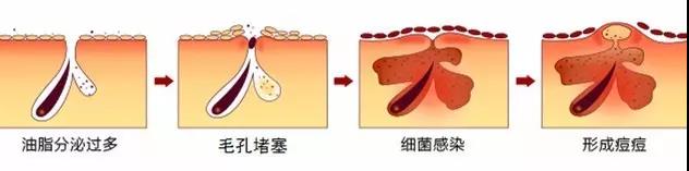 痘痘